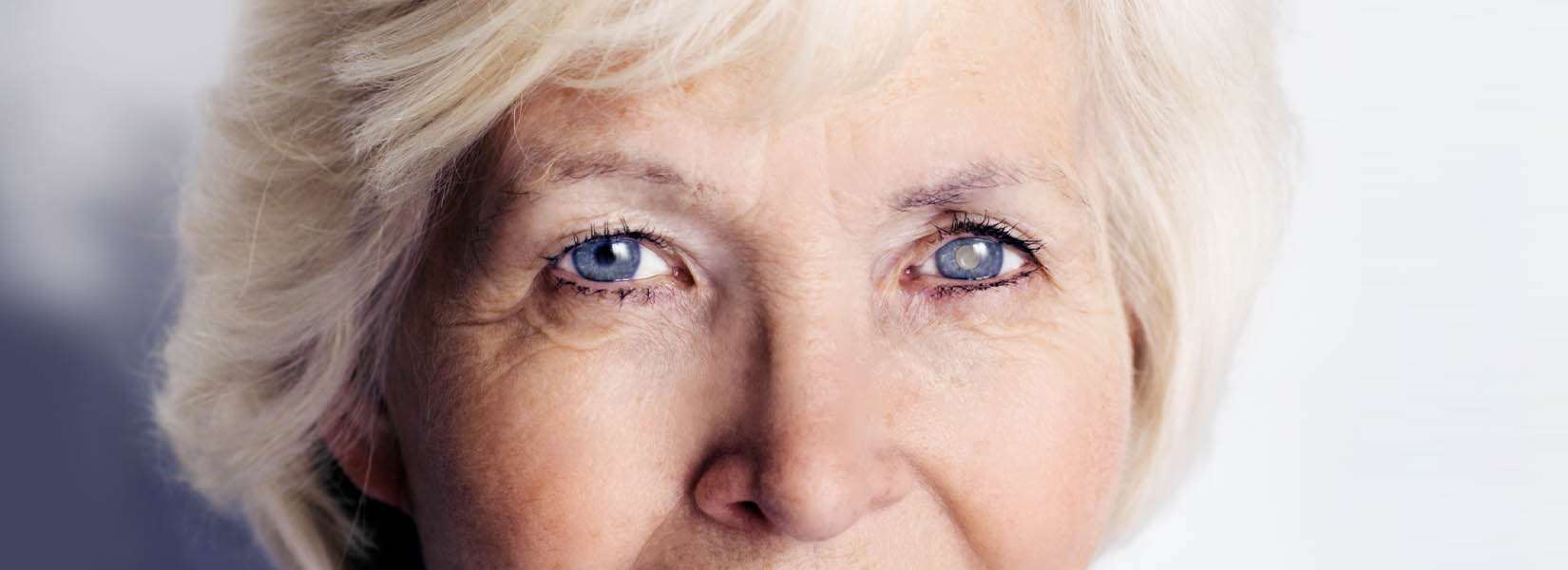 Cataract Surgery in Fountain Hills